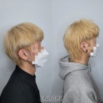 에르달 붙임머리