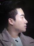산이 턱에 멍 자국이 있네요 - 뽐뿌:자유게시판 산이 턱에 멍 자국이 있네요