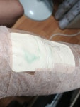 메디터치f 잘 아시는분 계신가요? - 뽐뿌:메디컬포럼 메디터치f 잘 아시는분 계신가요?
