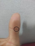 메이플스토리 인벤 : 엄지손가락 마디에 통증이있어요 ㅠㅠ - 메이플스토리 인벤 자유게시판 (구) 엄지손가락 마디에 통증이있어요 ㅠㅠ