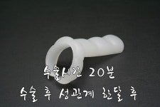 『남자의본능』비뇨기과,남성수술,남성비뇨기과,조루수술,조루증 | 남성 실리콘보형물의 종류는 어떤것이 있을까요? - Daum 카페 남성... 