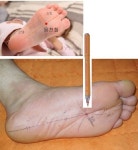 원인과 제니센 치유방법 - ▣ 제니센 터치 치유상담 - 힐링 라이프 생리시 극심한 두통과 울렁거림 구토 증상의 원인과 제니센 치유방법