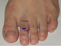 원인과 제니센 치유법 - ▣ 제니센 터치 치유상담 - 힐링 라이프 복부... 냉증 적취 (뭉침 증상)로 어깨와 목이 뻣뻣한 항강증의 원인과 제니센 치유법