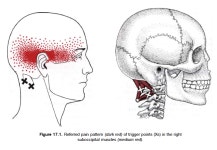 후두하근(소후두직근, 대후두직근, 상두사근, 하두사근) - 모든 근육과... 영성 연구소 후두하근(소후두직근, 대후두직근, 상두사근, 하두사근)