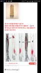 제니센 덤으로 선물받은 기분입니다. - ▣ 국내 제니센 치료사례 - 건강한 삶을 열어가는 힐링라이프 건강한 삶을 열어가는 힐링라이프