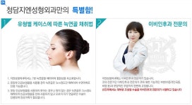 정현정원장-청담지엔성형외과 코성형 - 성형 갤러리