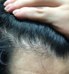 고민입니다.고민입니다. > 대다모 > 맨앤네이처성형외과