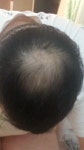 저는 어떤 가발을 써야 할까요? > 대다모 > 가발전문가상담/견적