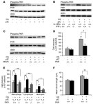 JCI -Cigarette smoke selectively enhances viral PAMP– and virus-induced pulmonary innate immune and remodeling responses in mice