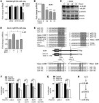JCI -IL-6R/STAT3/miR-34a feedback loop promotes EMT-mediated colorectal cancer invasion and metastasis