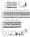 JCI -B56δ-related protein phosphatase 2A dysfunction identified in patients with intellectual disability