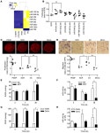 JCI -MicroRNA-140-5p and SMURF1 regulate pulmonary arterial hypertension