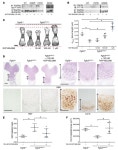 JCI -Tyrosine kinase inhibitor NVP-BGJ398 functionally improves FGFR3-related dwarfism in mouse model