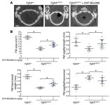 JCI -Tyrosine kinase inhibitor NVP-BGJ398 functionally improves FGFR3-related dwarfism in mouse model