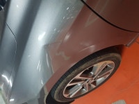 덴트문의..맴찢.. | 보배드림 자유게시판