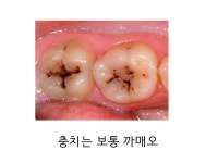 안녕하세오 치과의사에오 - 인스티즈(instiz, 音思提资) 인티포털 안녕하세오 치과의사에오