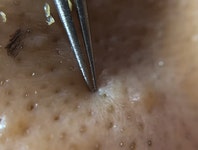 더러운데 계속 보게 되는 피지 제거 - 인스티즈(instiz, 音思提资) 인티포털 더러운데 계속 보게 되는 피지 제거