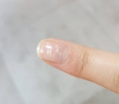 손톱에 하얀 점?? 이거 왜 생기는 걸까 - 인스티즈(instiz) 일상 카테고리 손톱에 하얀 점?? 이거 왜 생기는 걸까