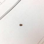 와 나 다리에 묵혀있던 피지 뽑아냈어 40 - 인스티즈(instiz) 일상 카테고리
