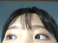 나 서울쪽인데 쌍수랑 앞트임 하고싶은데 병원 ㅊㅊ좀 ㅠㅠ - 인스티즈(instiz) 뷰티 카테고리