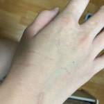 박냐옹이 어제 내 손이랑 싸워ㅆ나봄 ㅠㅠ - 인스티즈(instiz, 音思提资) 익명잡담 [익명잡담] 박냐옹이 어제 내 손이랑 싸워ㅆ나봄 ㅠㅠ