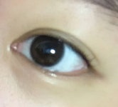 눈 트임 할까 생각중인데 어떻게 생각해? - 인스티즈(instiz) 뷰티 카테고리