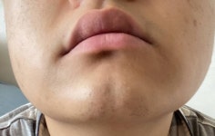 하관 뭐뭐 해야될까..? - 인스티즈(instiz) 뷰티 카테고리
