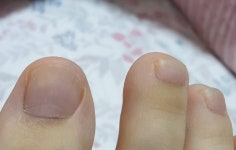 나 손톱발톱 색봐바.. - 인스티즈(instiz) 익명잡담 나 손톱발톱 색봐바..