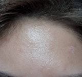 다들 이마모공 어느정도야? 내 이마모공 넓은거니 - 인스티즈(instiz) 일상 카테고리 다들 이마모공 어느정도야? 내 이마모공 넓은거니