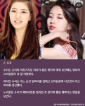 이 연예인 헤어라인 레이저제모한거 맞아?? - 인스티즈(instiz) 뷰티 카테고리 이 연예인 헤어라인 레이저제모한거 맞아??