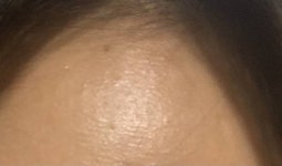 이거 이마에 주름이야? - 인스티즈(instiz) 일상 카테고리 이거 이마에 주름이야?