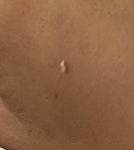 ㅎㅇㅈㅇ 여드름 왕건이 볼 사람 - 인스티즈(instiz) 일상 카테고리
