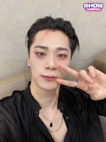 [잡담] 아스트로 문빈 이마에 꽤 큰 수술흉터 있는데 - 인스티즈(instiz) 연예 카테고리