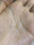 내 왕건이 귀지 보고 갈 사람~? ㅎㅇㅈㅇ - 인스티즈(instiz) 일상 카테고리 내 왕건이 귀지 보고 갈 사람~? ㅎㅇㅈㅇ