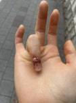 손 이렇게 됐는데 병원 가야할 정도야?? (ㅎㅇㅈㅇ) - 인스티즈(instiz) 일상 카테고리 손 이렇게 됐는데 병원 가야할 정도야?? (ㅎㅇㅈㅇ)