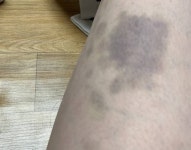 머선 멍이 이렇게 들었는지.. - 인스티즈(instiz) 일상 카테고리 머선 멍이 이렇게 들었는지..