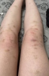 다리에멍이 - 인스티즈(instiz) 일상 카테고리 다리에멍이