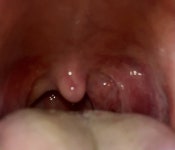 나 목구멍이 아파서 사진찍었늠데 이거 부은건가? ㅎㅇㅈㅇ - 인스티즈(instiz) 일상 카테고리