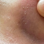 [잡담] 와 코 옆에 이거 피지 어캄…? 진짜 극혐이다 ㅎㅇㅈㅇ - 인스티즈(instiz) 일상 카테고리