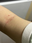 [잡담] 아니나만이래? 무거운가방 들면 팔에 상처자국 남는거 - 인스티즈(instiz) 일상 카테고리