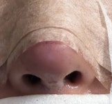 [잡담] 코수술 한 익인들 있어?? 코수술 한지 3일차인데 코끝 이정도로 빨간거 정상이야? - 인스티즈(instiz) 일상 카테고리