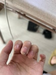 [잡담] 앞으로 넘어지면서 손으로 바닿 짚어서 (ㅎㅇㅈㅇ) - 인스티즈(instiz) 일상 카테고리