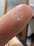 [잡담] 나 딱딱한 피지 짰어 멍구 사진도 찍음 - 인스티즈(instiz) 일상 카테고리