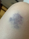 [잡담] 으악 멍 겁나 크게 듬 - 인스티즈(instiz) 일상 카테고리 으악 멍 겁나 크게 듬