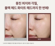 [잡담] 이거 나만 사용전이 피부 더 좋아보여? - 인스티즈(instiz) 일상 카테고리