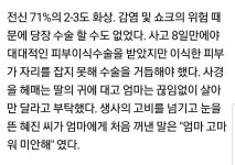 여름철 스프레이형 모기약 사용시 주의할점 - 인스티즈(instiz) 이슈 카테고리