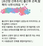 사회에서 안 알려주는 출산 후 증상 - 인스티즈(instiz) 이슈 카테고리 사회에서 안 알려주는 출산 후 증상