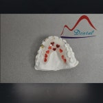 Customized Hawley Dental Retainer(id:10437693). Buy China Customerized Hawley Dental Retainer, Dental Hawley Retainer, Dental... 
