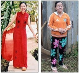 베트남 20대女‘저주 걸린 공주’처럼 70대로 한순간에… - 조선일보 > 국제 > 국제 일반 베트남 20대女‘저주 걸린 공주’처럼 70대로... 