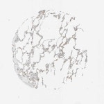 Tissue expression of CSK - Staining in lung - The Human Protein Atlas